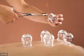 拔火罐拔出的小水珠，真的是体内的湿气吗？看完就懂了图片