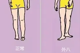 “外八腿”走出穿衣雷区，2招教你挑选合适的下装，从视觉上改善图片