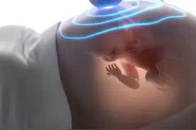 孕4个月肚子有“针扎样疼痛”，别担心！可能是这3种情况，附建议图片