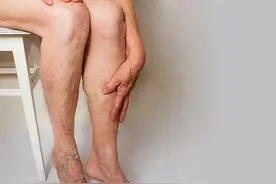 糖尿病人出现腿疼，多见于这三种情况，如何治疗，医生告诉您！图片