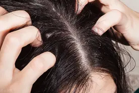 头发总出油怎么办？教你5招，或能摆脱大油头，使头发柔顺蓬松图片
