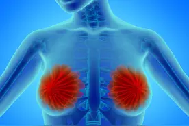乳房发红发热当心是乳癌图片