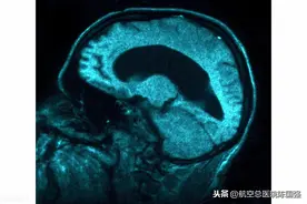 陈国强：新手妈妈应该怎么预防婴儿患有脑积水呢？图片