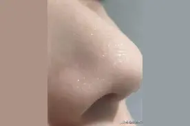 这才是去黑头的正确方式，安全有效不伤肤，无暇鸡蛋肌你也能拥有图片