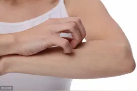 过敏也可能诱发心脏病图片