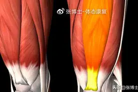 「体态康复」股四头肌紧张与下背部疼痛的关系图片