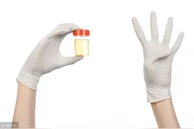尿酸水平高于这个值，可能患有高尿酸血症！日常做好3点降尿酸图片