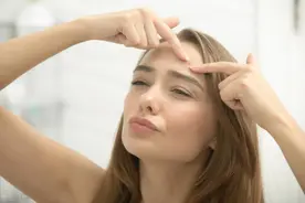 为什么头皮总长“痘痘”和“疙瘩”？医生：或与3种疾病有关图片