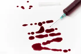 我国两类艾滋病感染人数显著增加！艾滋病感染者性传播比例达95%以上图片