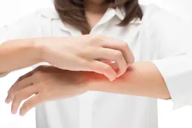 皮肤病常用药痤疮荨麻疹湿疹痱子冻疮鸡皮肤毛囊炎用什么药图片