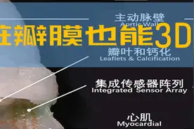 3D打印｜研究人员打印出高仿真心脏瓣膜模型图片