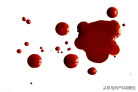 辟谣：同房后出血不要紧？你以为的太奔放，可能是一场惨案图片