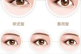 韩式双眼皮效果如何？与欧式双眼皮区别在哪？图片