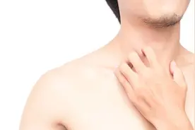 天啊！因为一颗扣子，皮肤反复过敏，而且它还保留“记忆”图片
