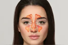 如何用盐水洗鼻治疗鼻窦炎图片