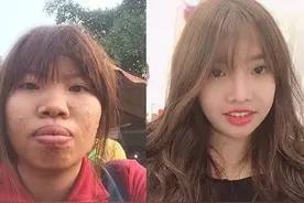 丑姑娘花9万整容后嫁富二代，生完孩子后被抛弃如今成网红图片