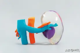 肾模型3D打印成果展示图片