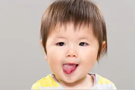 张嘴就见“花舌头”很搞笑吗？专家：地图舌也是病，该讲究得讲究图片