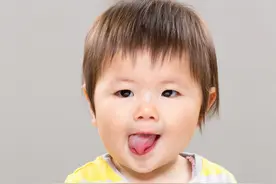 张嘴就见“花舌头”很搞笑吗？专家：地图舌也是病，该讲究得讲究图片