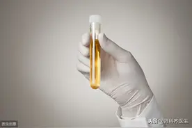 尿潜血就是血尿吗？尿潜血危害性大吗？图片