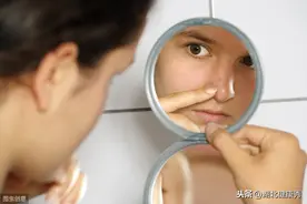 痘痘长个不停，想抠又不敢抠？教你一个不留疤的祛痘秘诀图片