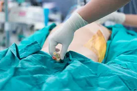 剖腹产“疼痛难忍”的8个瞬间，你知道吗？欢迎对号入座图片