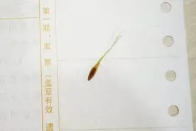 农妇眼睛磨得慌，几家医院都说没问题，最后竟发现是它惹的祸图片