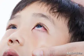 关于眼睛，这些知识你应该知道图片