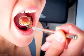 矫牙有年龄限制吗？孕妇能不能矫牙？关于正畸问题的答案都在这图片