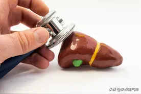 肝胆相对照，病变早提示！这5个信号是肝发出的图片