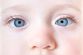 幼儿一只眼斜视，要紧吗？图片