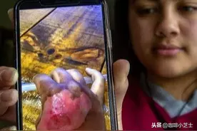 你有没有被麦当劳的咖啡烫到过？如果烫伤严重，可以要求换一杯图片