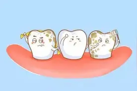 笑口难开的尴尬——氟斑牙图片