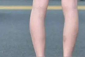 如何才能让自己的大腿变得更直、缝隙更小些呢图片