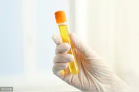 出现这3种现象，说明你的尿酸已经很高了图片