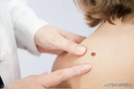 身上出现很多小红点，不痛不痒的别不当回事，小心是这些疾病来访图片