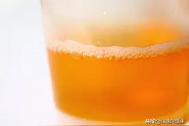 女性小便有泡沫是怎么回事？当心是这四个疾病在作怪图片