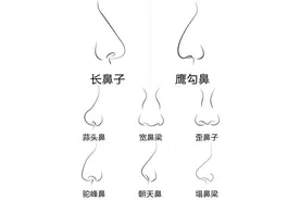 千奇百怪的鼻子，你是啥鼻？图片