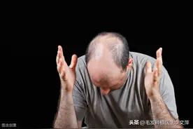 只有男性会脱发吗，难道女性不会吗？图片