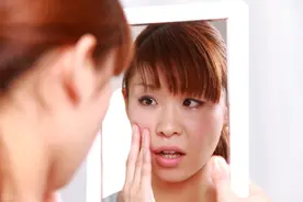 鱼鳞病带给我的噩梦图片