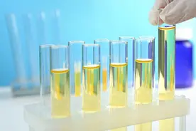排尿时，如果出现这4种现象，要注意，可能是你的肾出现问题了图片