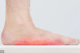 改善功能性平足，健身运动图片