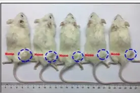 成功逆转癌细胞！中国专家取得抗癌突破，肝癌细胞回归健康状态图片
