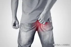 摆脱让你坐立不安的痔疮，介入栓塞治疗轻松搞定图片
