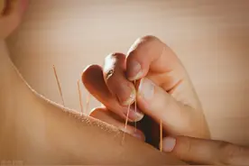针灸师征服不了的穴位！中医为你揭开，“印堂穴”神秘的面纱图片