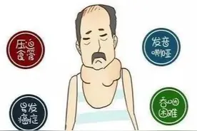 甲状腺肿、弥漫性甲状腺肿大？甲状腺肿早中晚期警惕这些不同症状图片