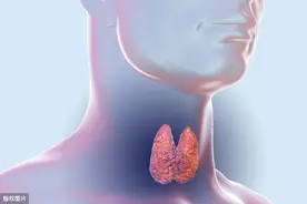 甲状腺切除术后伤口化脓咋办图片
