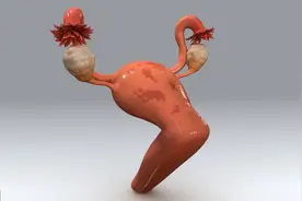 腺瘤性肠息肉，切了也要警惕癌变图片