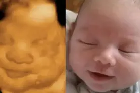 24周四维彩超一次过，看到照片孕妇哭笑不得，感叹老公基因太强图片