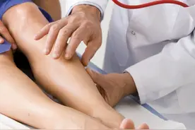小腿经常水肿是病吗？不一定！4个原因最常见！附检查和治疗方法图片